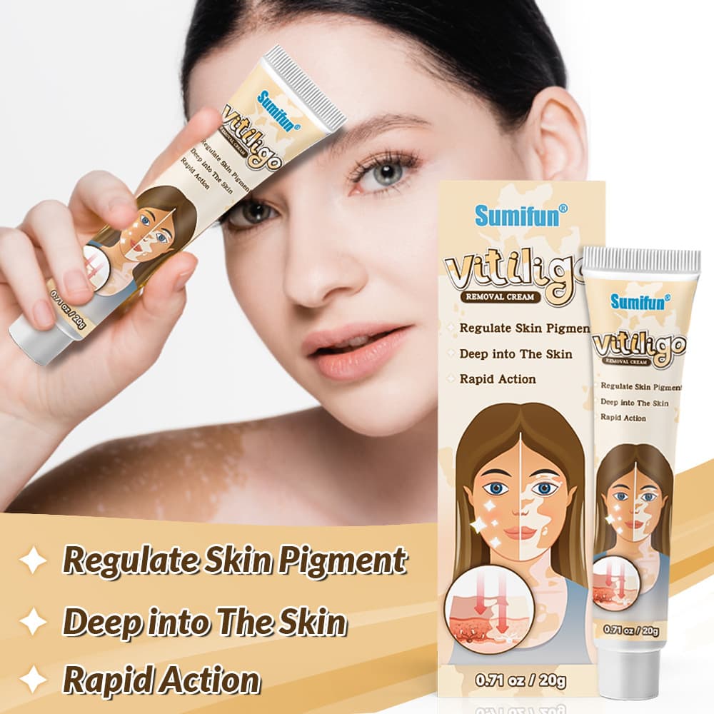 SumiFun vitiligo cream, Shrimp Skin, Amazon cross-border ointment, vitiligo treatment, patchy skin moisturizing cream.