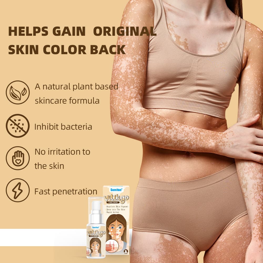 SumiFun Amazon Cross-Border Plaster for Vitiligo Removal Spray, Spot Removal Lotion, Skin Vitiligo Spray K10271