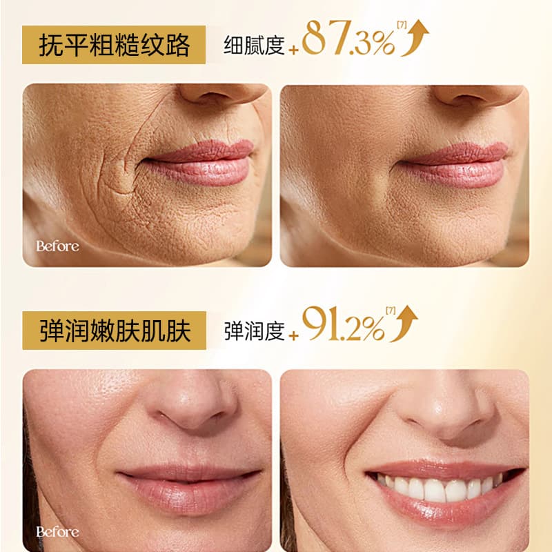 Recombinant Collagen Cream: Moisturizing, Firming, Reduces Forehead Wrinkles and Nasolabial Folds, Fills in Depressions, Firming, and Anti-Wrinkle Face Cream