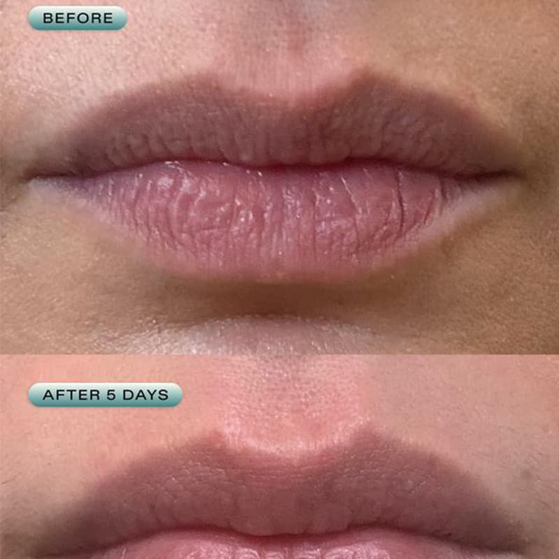 Cross-border TK best-selling TEMU milk lip care product, moisturizing, hydrating, and long-lasting.