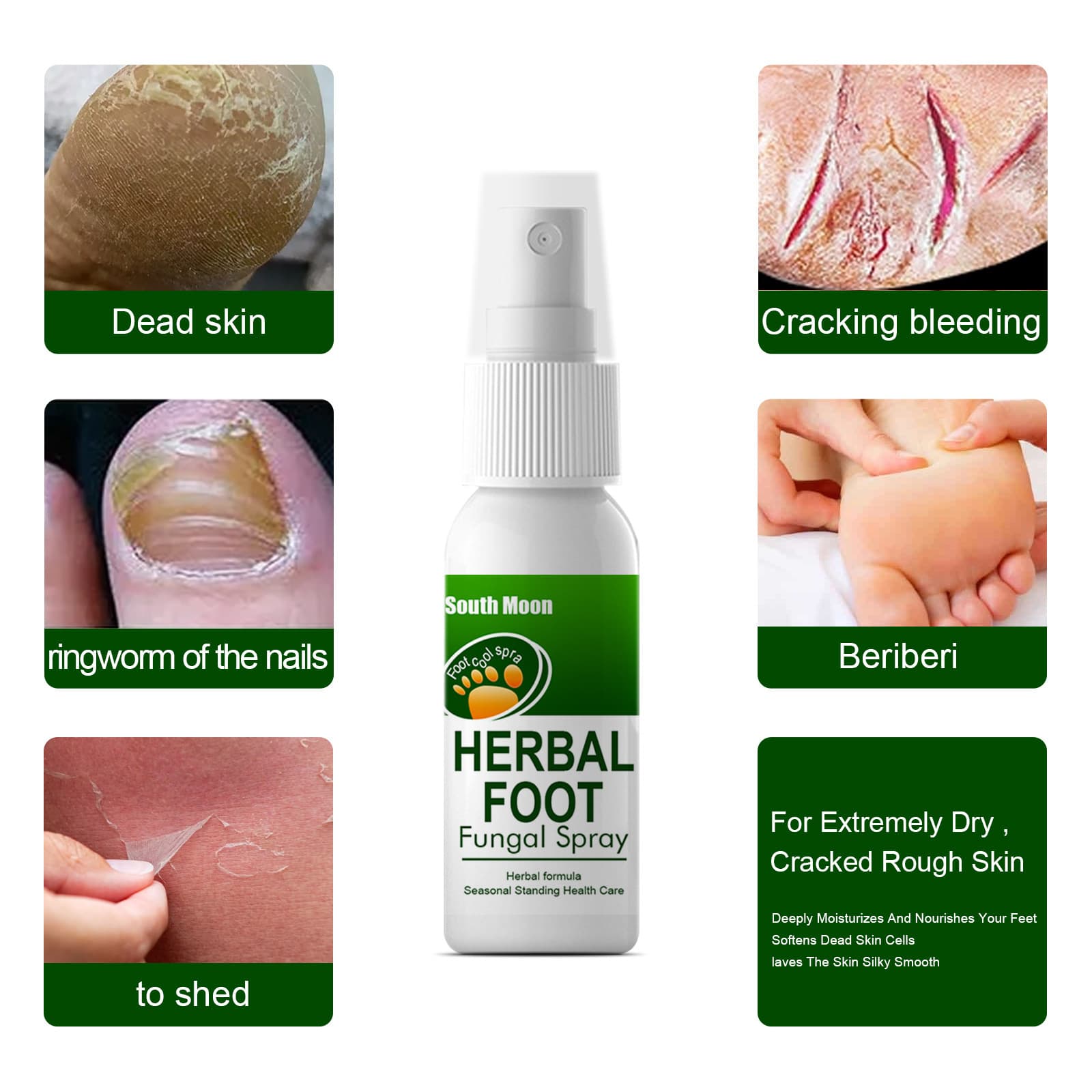 South Moon Herbal Foot Spray Athlete's Foot Deodorant Care Spray