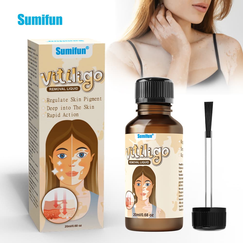 SumiFun Amazon Cross-Border Vitiligo Care Liquid, Evenly Apply Vitiligo Skin Topical Care Solution, K60018