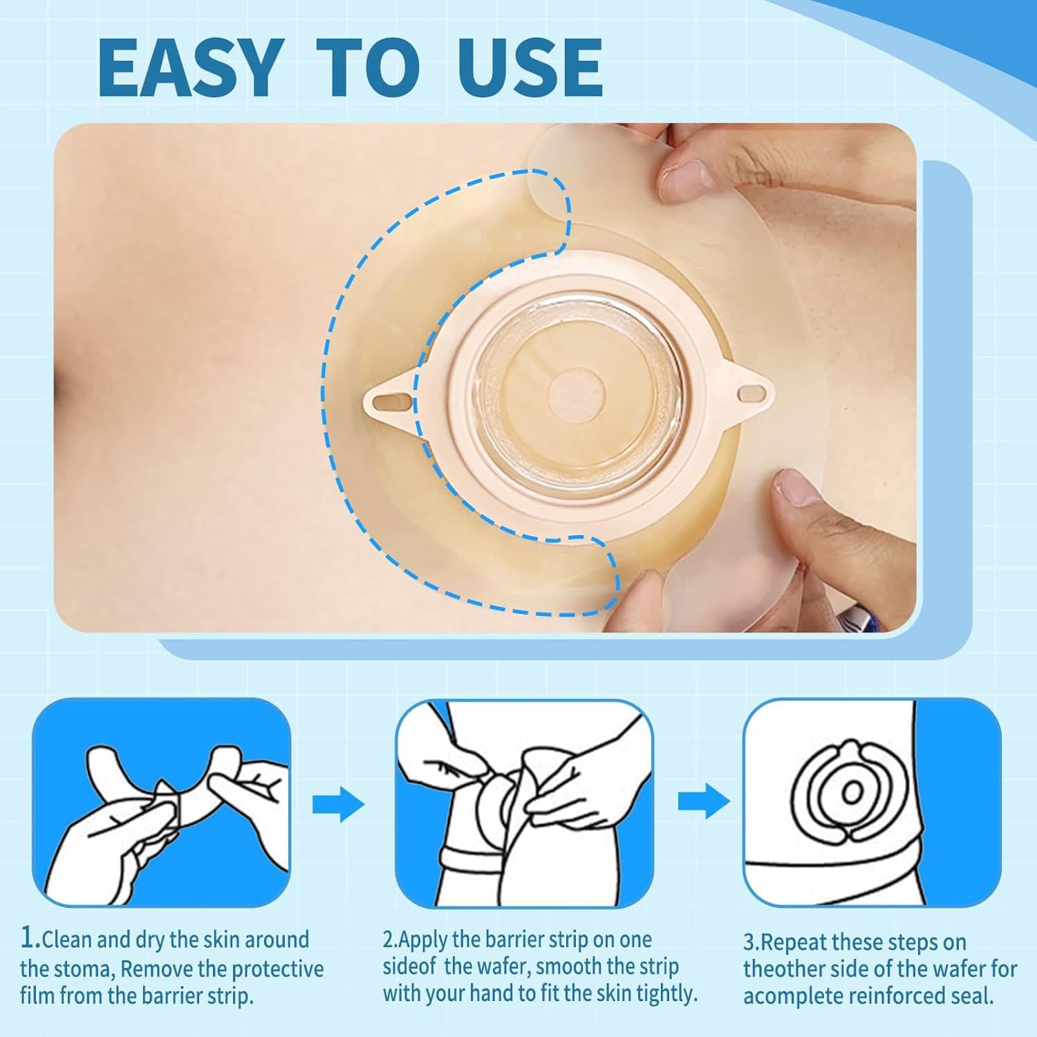 Ostomy Pouch Reinforcement Ring Hydrocolloid Stoma Care Accessories Baseplate Leak Proof Pressure Sensitive Tape