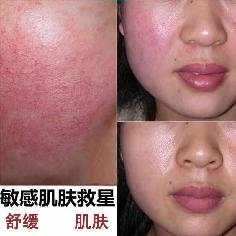 Shunianxue Soothing 3-Piece Set: Protects Sensitive Skin, Reduces Redness, Dryness, and Itchiness, Strengthens Skin Barrier, and Soothes Essence