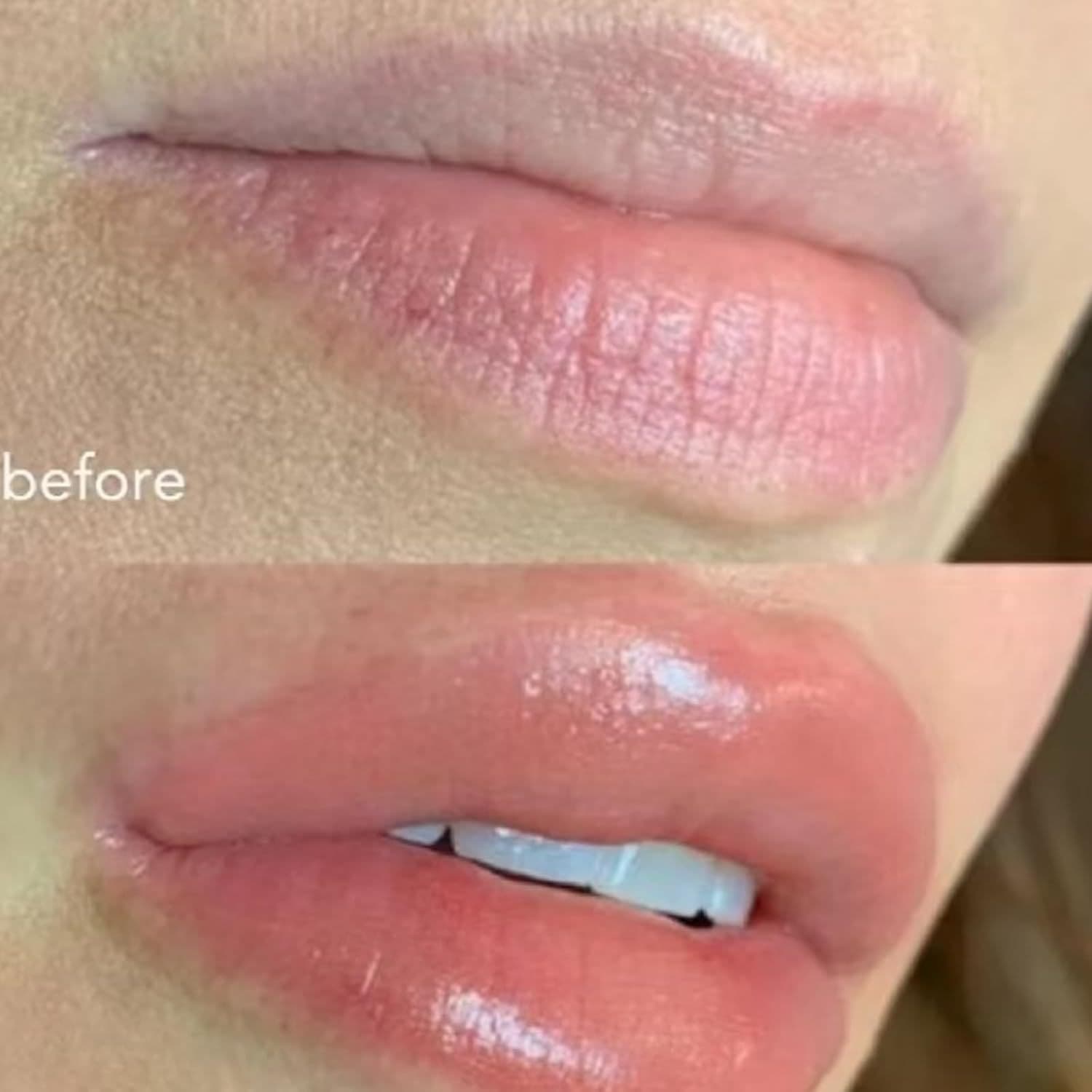 Glow Tulip Lip Plumper, a moisturizing lip balm that nourishes and protects lips.