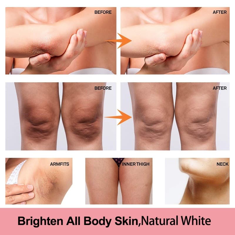 Cross-border repair cream for elbows, knees, lightening and whitening sensitive areas, brightening and removing dark spots, and underarm skin beautifying and brightening cream.