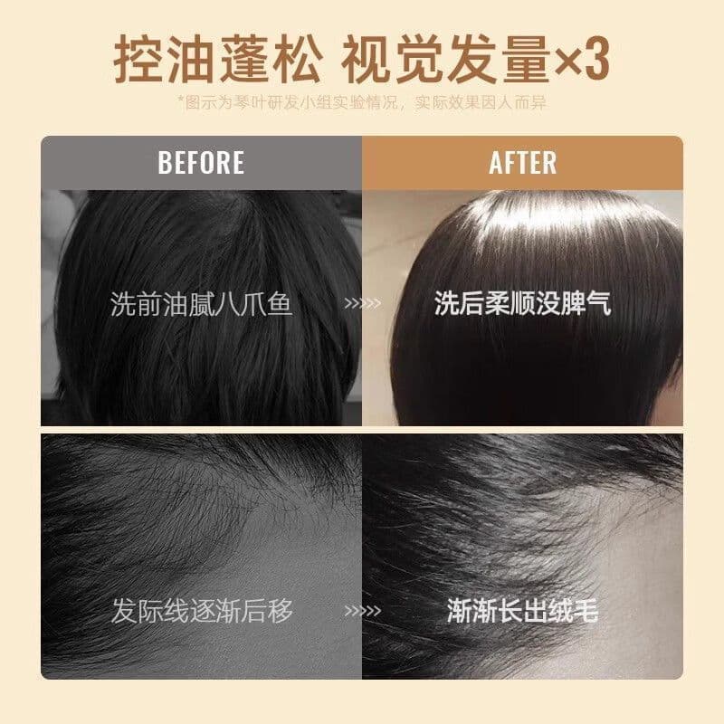 Authentic Qin Ye Ginger Shampoo, Ginger Mud Conditioner, Ginger Juice - Controls Oil, Prevents Hair Loss, Removes Dandruff, Relieves Itching, and Moisturizes
