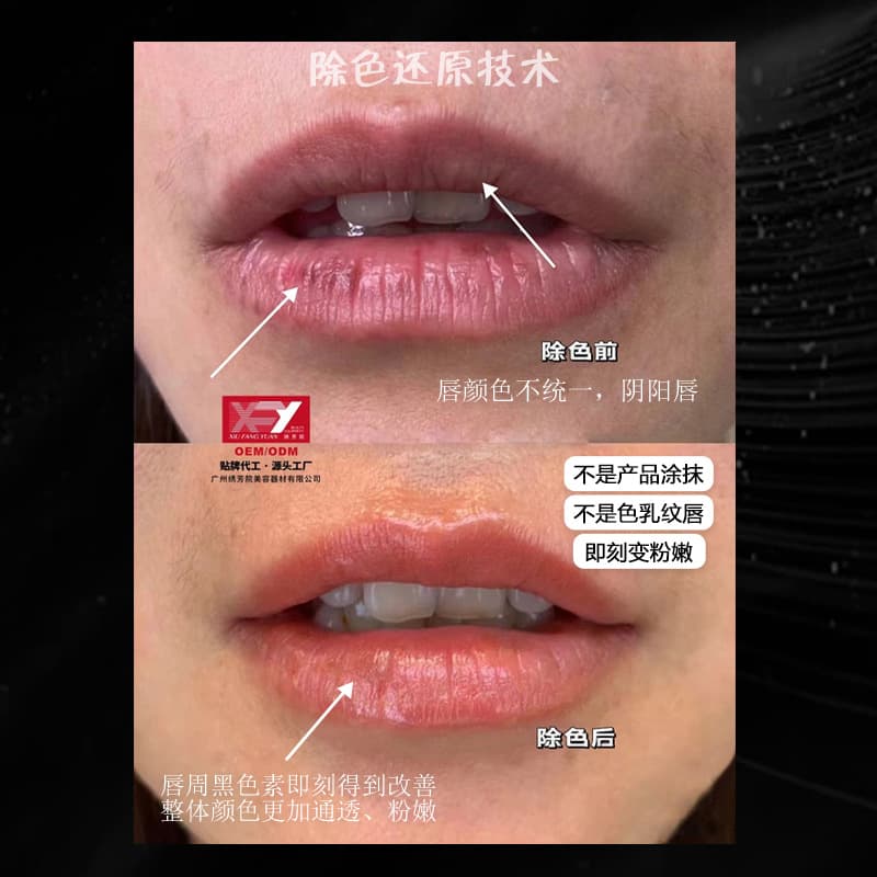 Salon-grade permanent makeup removal to restore pink and rosy lips, dark lips, and pigmentation removal with enzyme-based color-restoring agents.