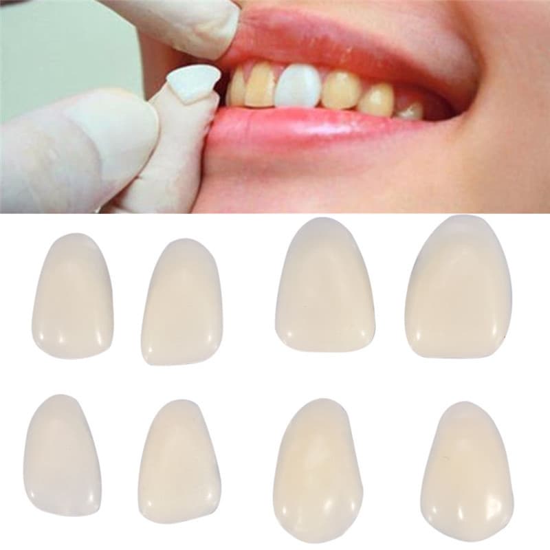 Dental Veneer Laminate A1 A2 Shade Temporary Tooth Veneer Oral Dental Material Tooth Veneer