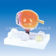 Glaucoma Anatomical Model Pathological Model