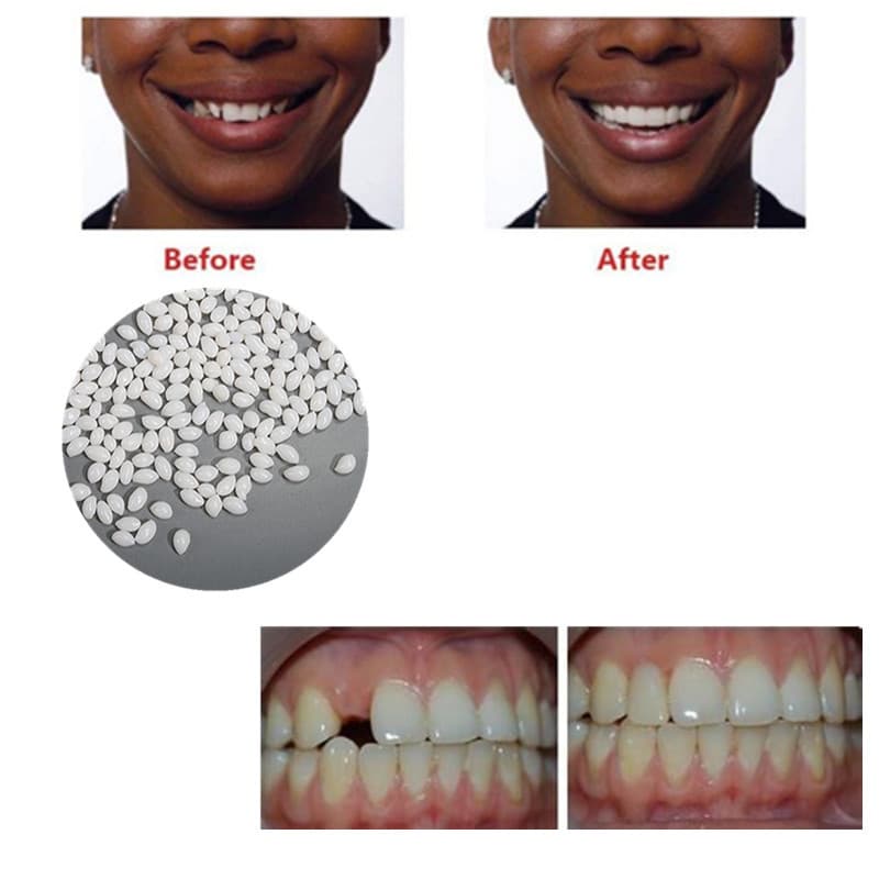 Solid Dental Gum, Gap Repair, DIY False Teeth Trays, Vampire Fangs, Zombie Teeth, Canine Covers