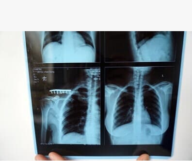 Medical film, medical blue film, complete specifications, inkjet laser, CR DR film, CT film