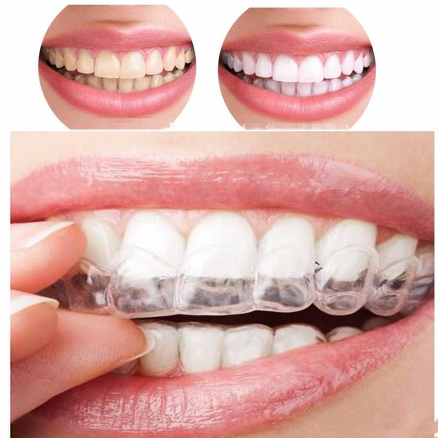 Teeth Whitening Gel with Moldable Invisible Trays Teeth Whitening Tool