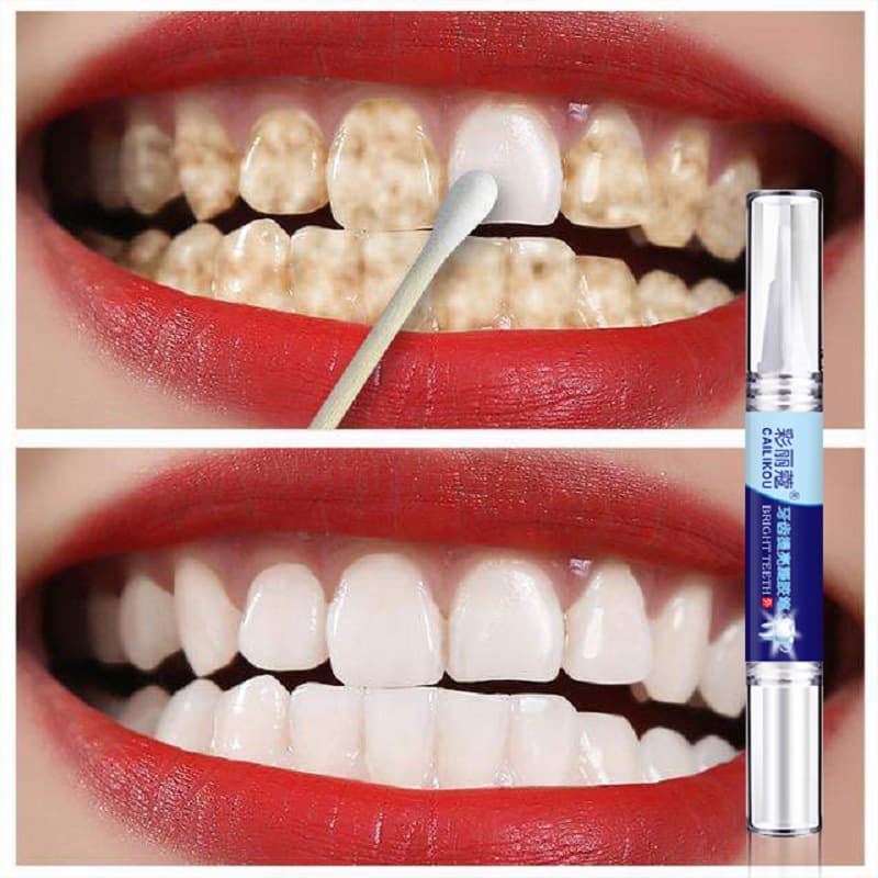 Teeth Whitening Pen Dental Care Removes Yellow Teeth Smoke Stains Tea Stains Fast Whitening Cleaning Brightening Pen