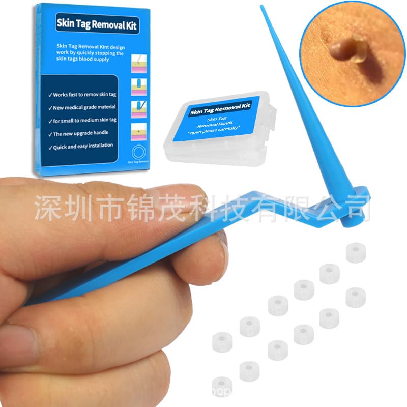 Skin Tag Remover Tag Refill Band for Skin Tag Removal