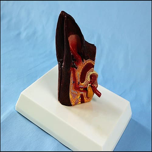 Diseased dog ear model