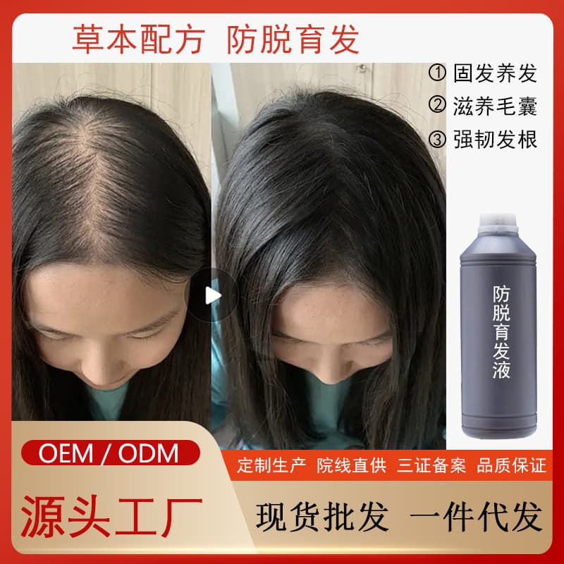 Hair Growth Serum, Hair Regrowth Treatment, Hair Density Nutrient Solution, Follicle Repair, Strengthen Hair Roots, Hair Care, Anti-Hair Loss, Hair Growth Essence