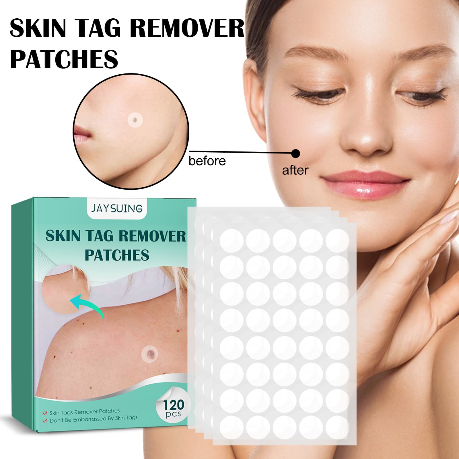 Hydrocolloid Acne Patches Invisible Concealing Acne Patches 120 Pieces Cross-border Foreign Trade Export Exclusive