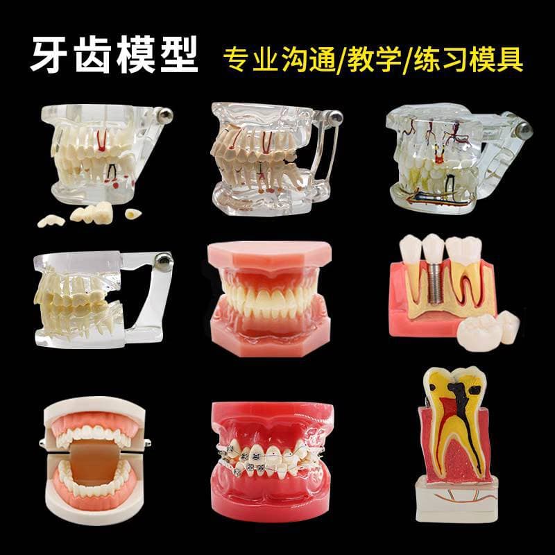 Dental Teeth Model Teaching Equipment Implant Model Doctor-Patient Communication Model Removable Comprehensive Case Model