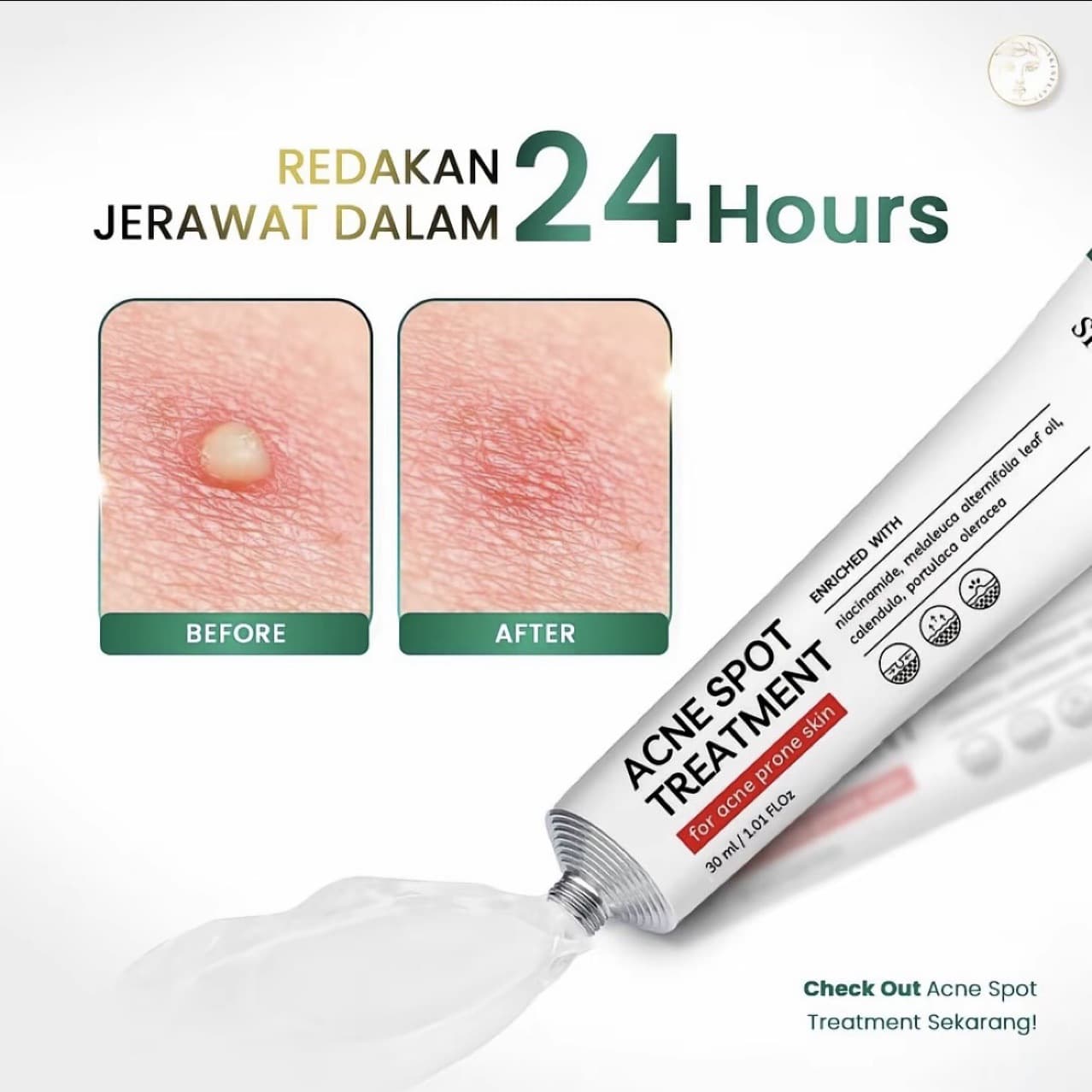 Cross-Border Best-Selling Acne Cream, Deep Moisturizing, Improving Redness and Dullness, Multi-Effect Gentle Care Cream