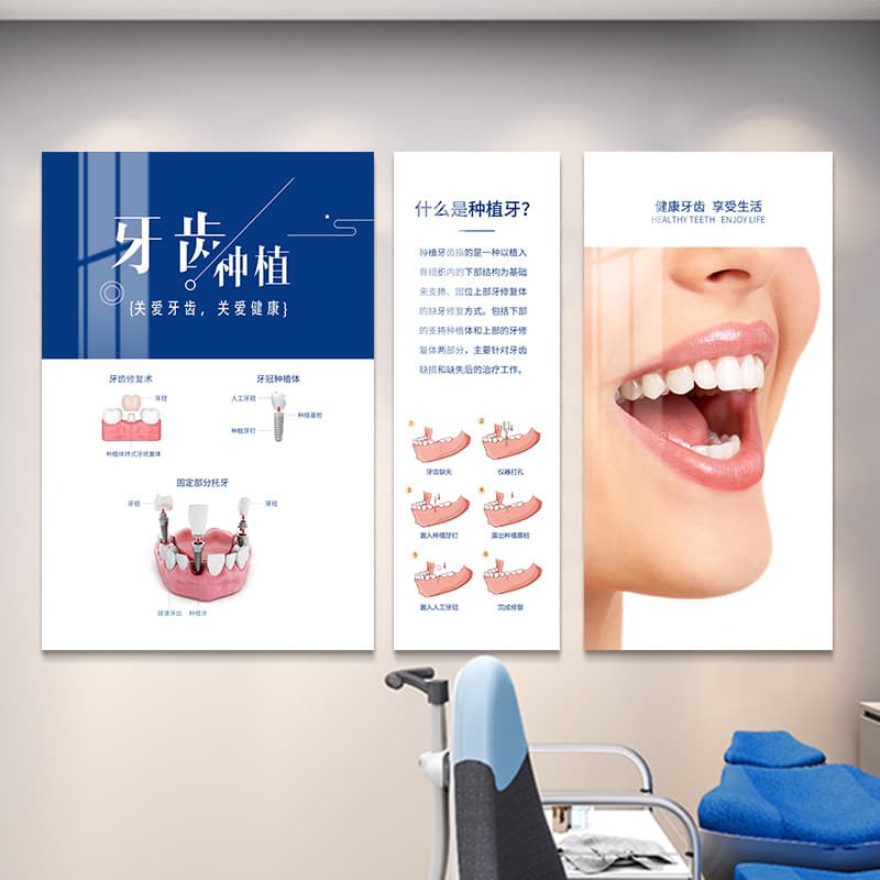 Dental Clinic Decorative Wall Art, Oral Implant Poster for Dental Office, Image Background Wall Culture Mural