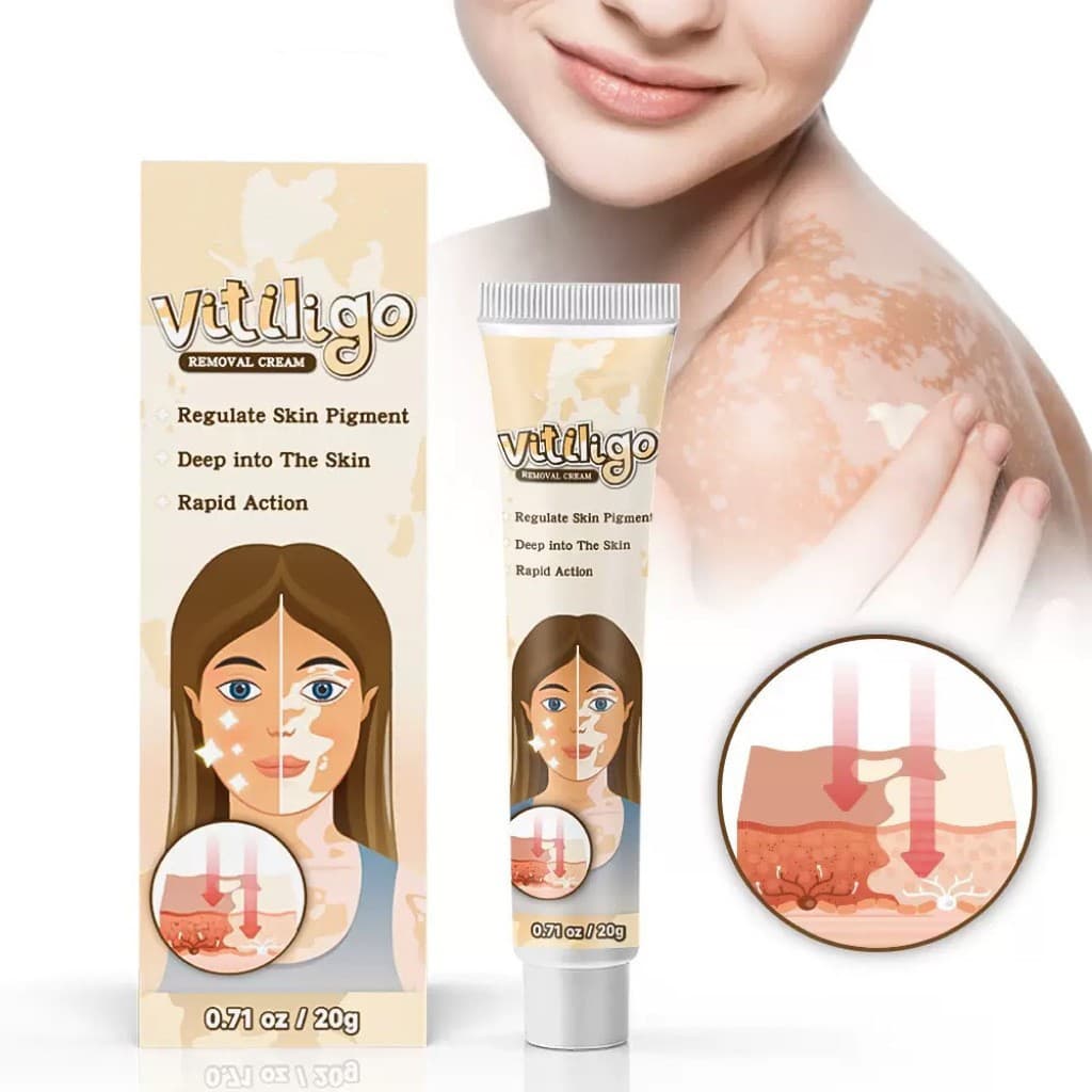 Hot-selling cross-border skin care cream, white spot ointment, blemish removal, moisturizing skin care cream