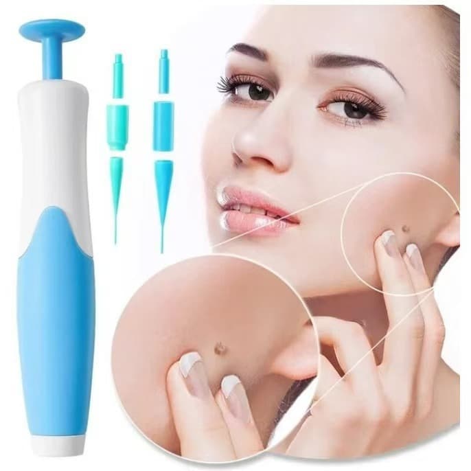 Skin tag removal pen, mole removal, corns removal, wart removal tool, blue box Skin Tag Removal Too