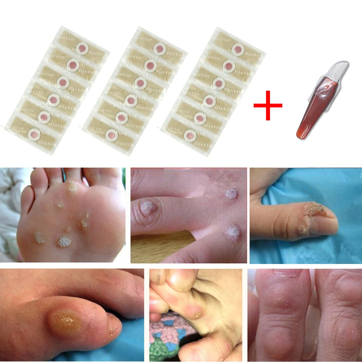 Corn Plaster Set for Removing Hard Skin, Calluses, Warts, Foot Corns, and Calluses – Manufacturer Direct