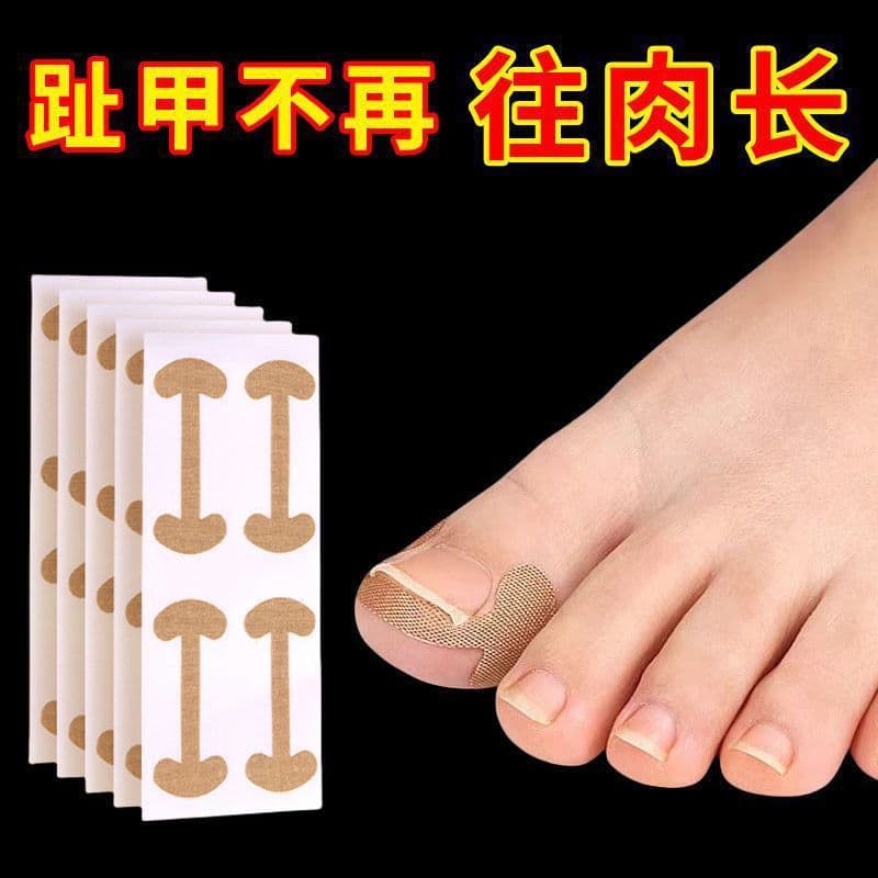 No-Glue Nail Correction Patch for Ingrown Toenails, Toenail Sticker, Nail Care, Factory Supply