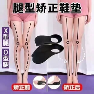 Flat Foot Correction Insoles for XO Legs, Foot Arch Support, Varus and Valgus Corrector Insoles