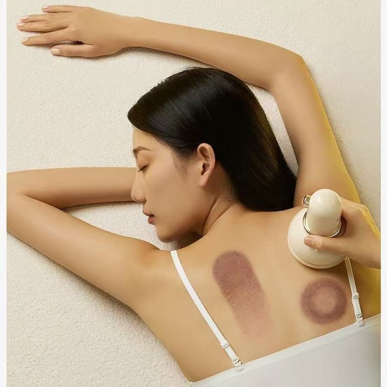 Pgg Electric Cupping and Scraping Device for Meridian Clearing, Intelligent Vacuum Cupping and Suction, Household Cross-Border Massage Artifact