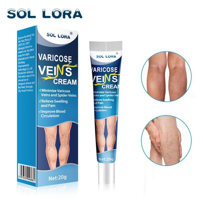 SOL LORA Varicose Vein Cream Blue Mailishu Ointment Spider Vein Cream Cross-border Exclusive Amazon In Stock
