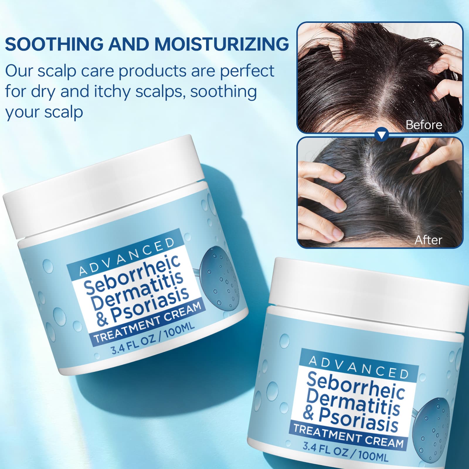 Cross-Body Care Cream Moisturizes Skin, Nourishes, Hydrates, Relieves Dryness on Scalp and Body, Soothing Moisturizing Cream