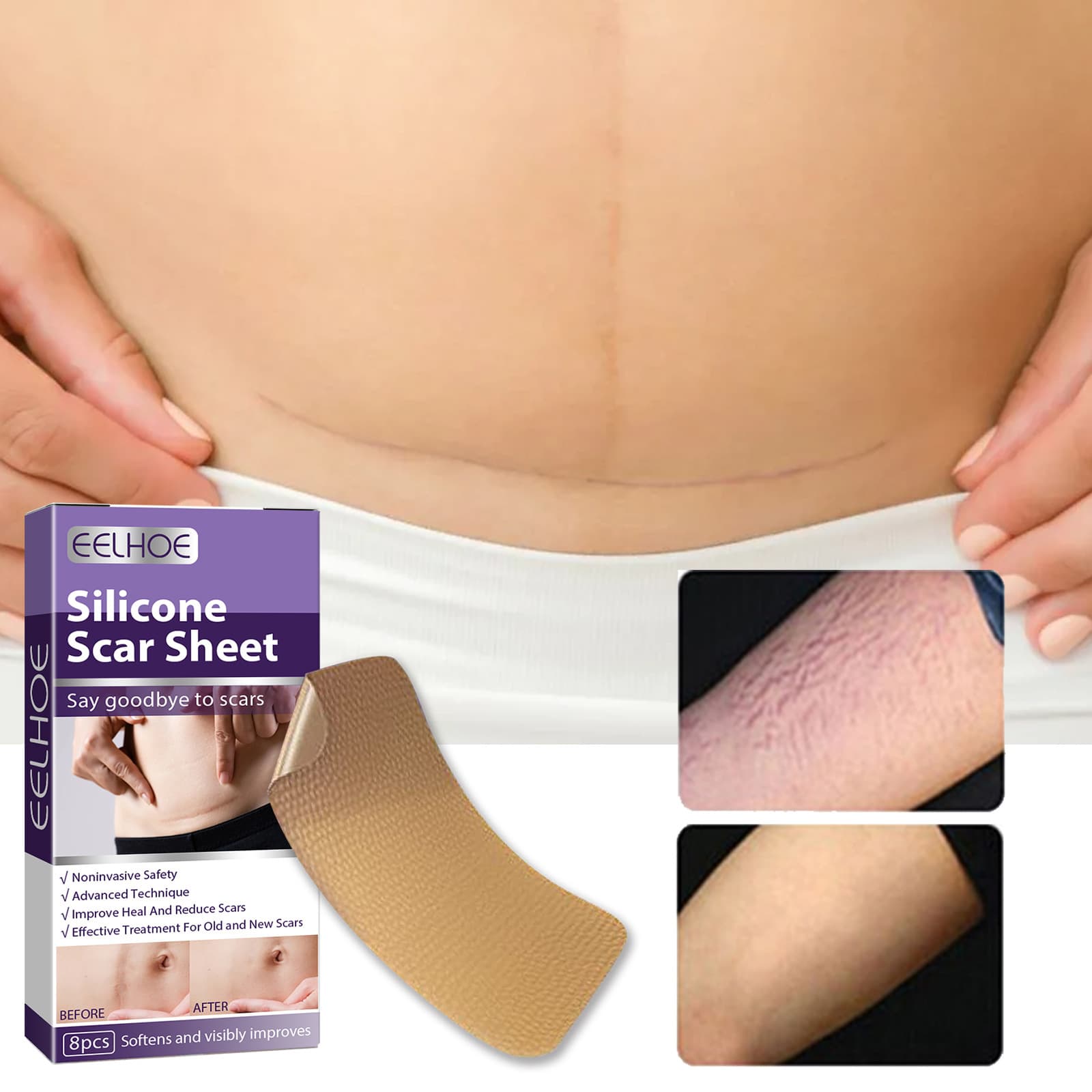 EELHOE Silicone Scar Patch for Fading Pregnancy, C-section, and Surgical Scars, Scar Care Repair Patch