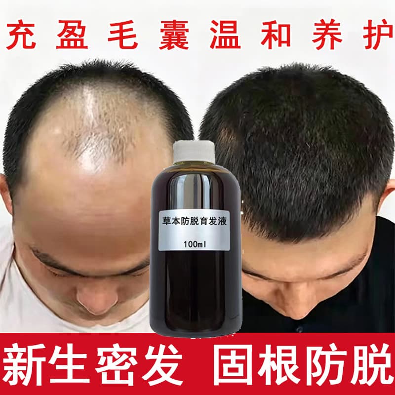 Polygonum Multiflorum Hair Growth Serum Nourishes Hair Follicles and Hairline, Herbal Hair Care Serum for Dense Hair, Blackening Hair with Platycladus Arborvitae Leaf Follicle Nutrition