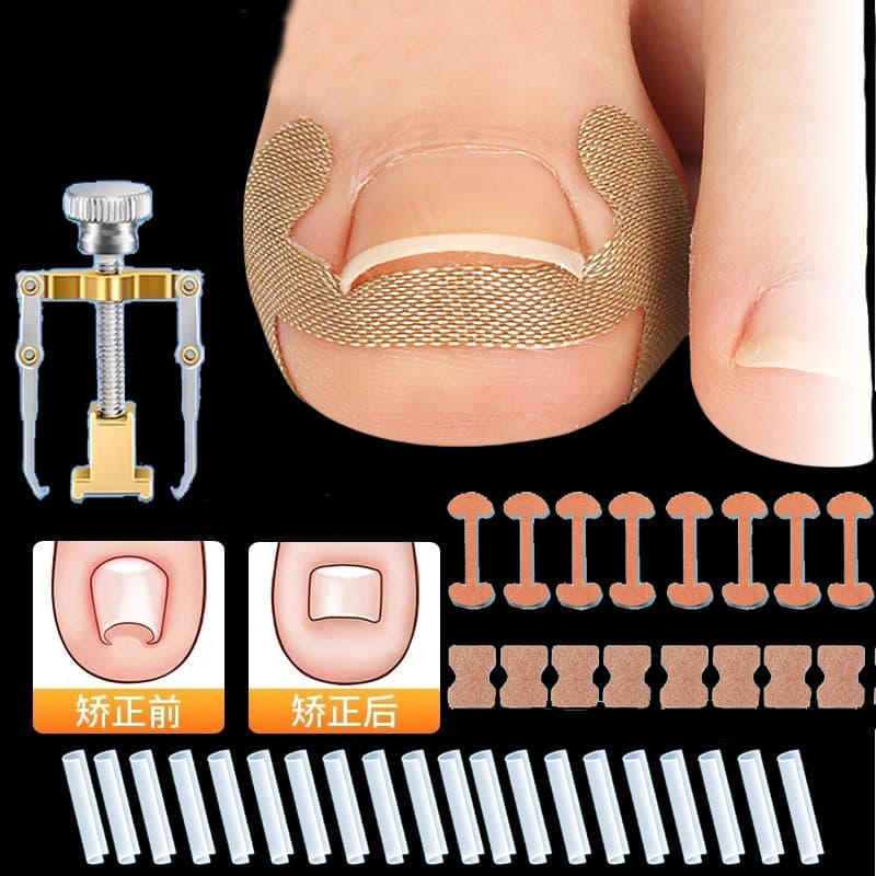 Nail Groove Corrector, Ingrown Toenail Correction Tool, Nail-Specific Correction Patch, Toenail Groove Isolation and Correction Sheet