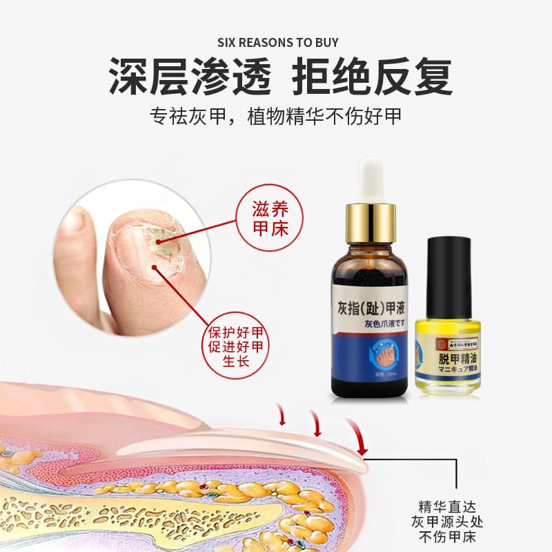 Tongrentang Nail Solution Foot Care Liquid Thickening Brightening Nail Fungus Removal Soft Nail Repair Essential Oil