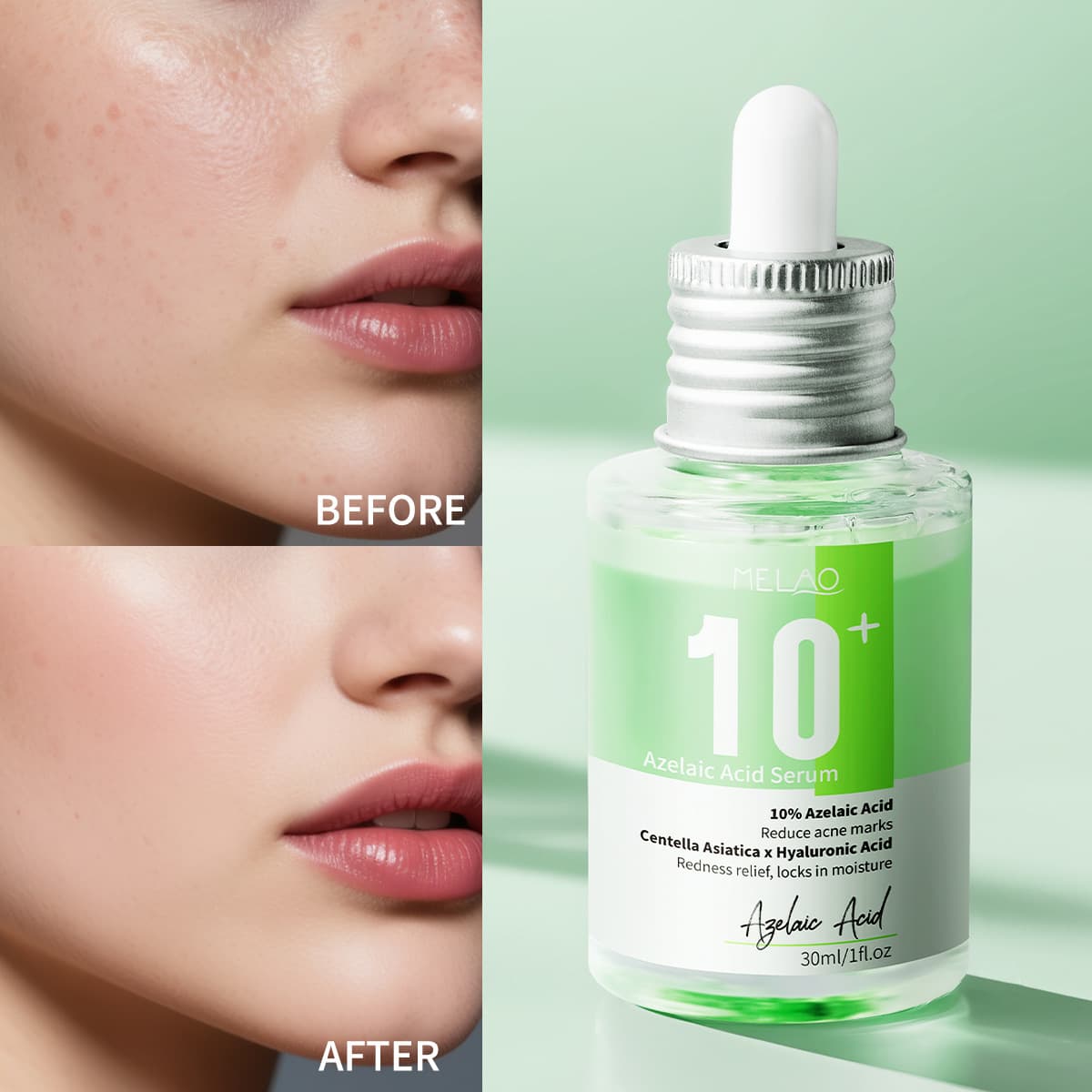 Cross-border Azelaic Acid 10 Hyaluronic Acid Moisturizing Essence Wholesale Azelaic Acid Serum Toner Hydrating Serum