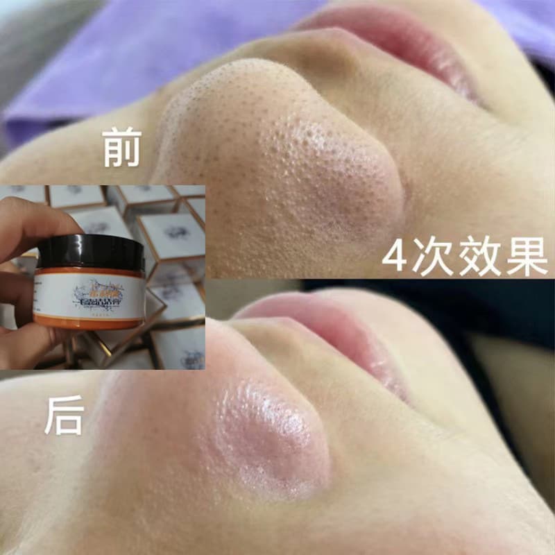 Spa Pore Cleansing Cream - Follicle Purifying Cream for Blackheads, Acne, and Clogged Pores with Extraction Massage