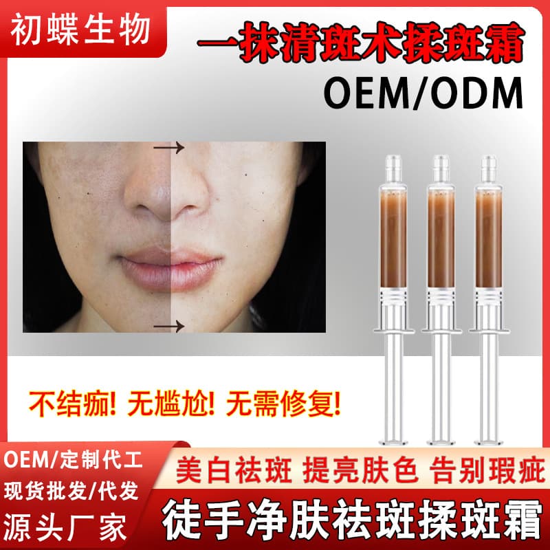 Professional Manual Spot Removal Gel Cream for Freckles, Dermal Spots, Pigment Decomposition, Color Control, Whitening, and Brightening