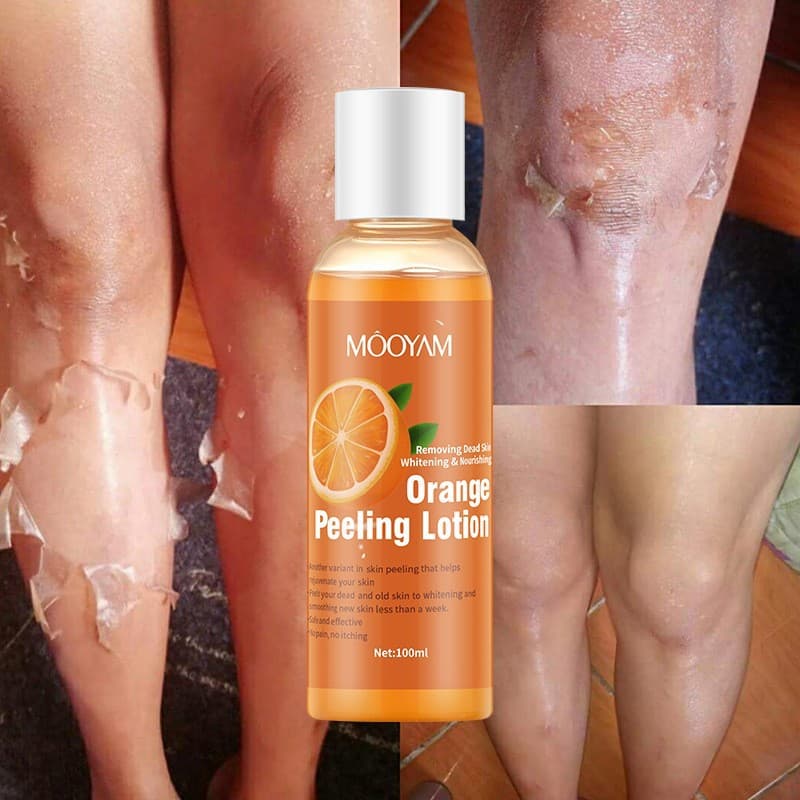 Orange Peel Lotion Exfoliating Body Lotion Gentle Exfoliating Gel