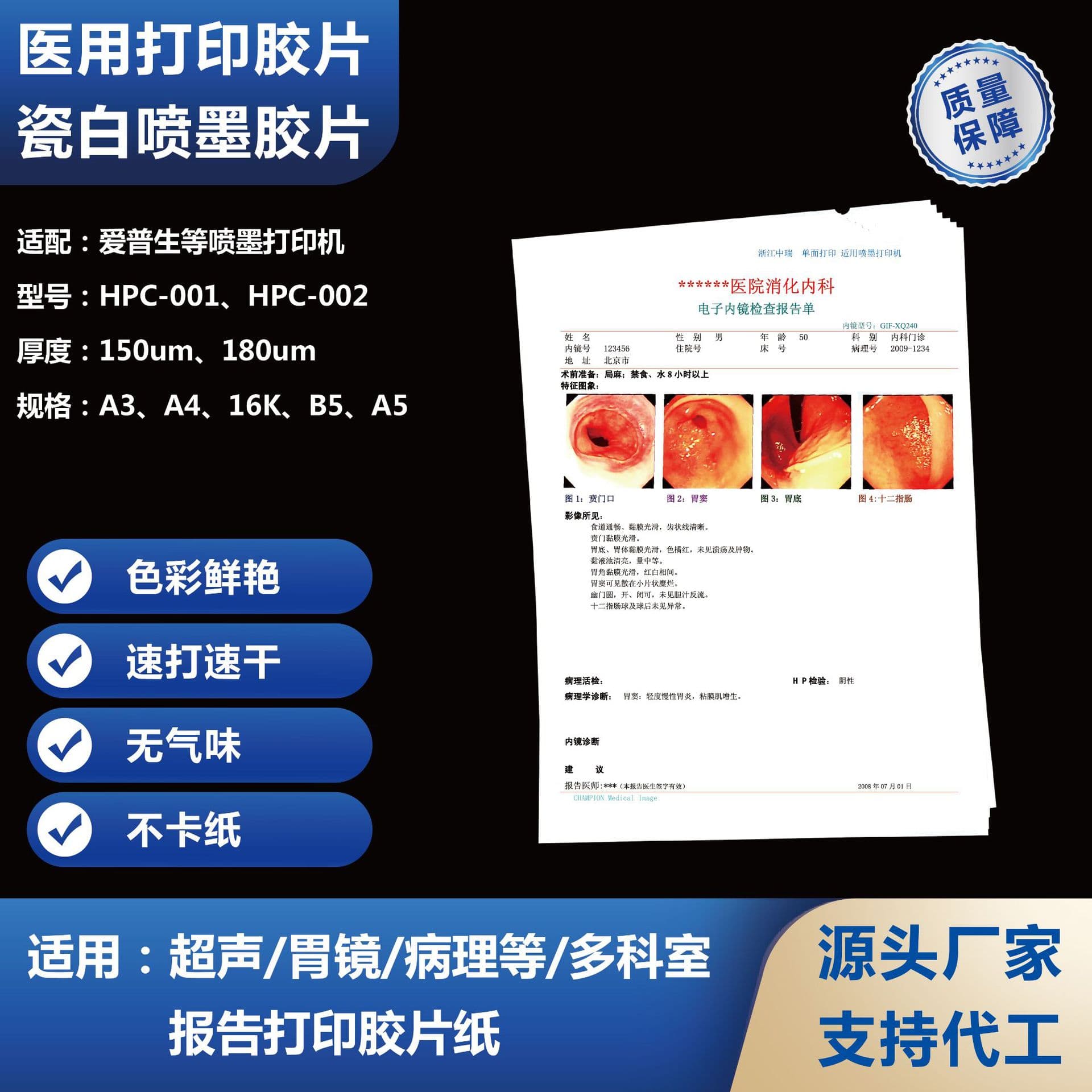 Medical Film Pure White Inkjet Printing A4 Gastroscope 4D B-Ultrasound Color Ultrasound Printing Paper Source Stock Product