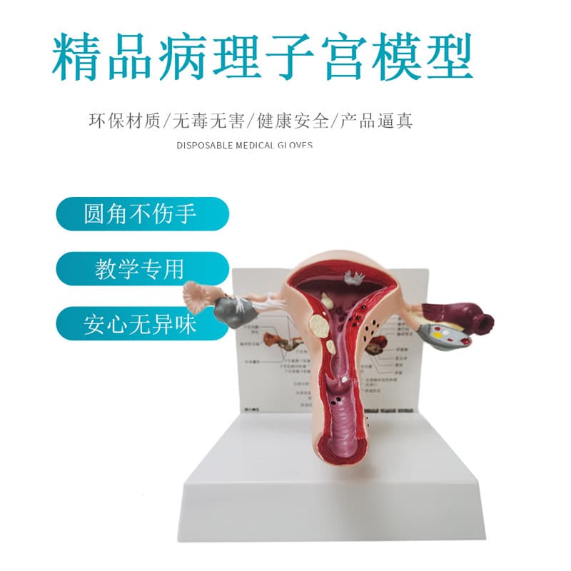 Human anatomy model uterine lesion model female internal reproductive system reproductive structure gynecological egg display teaching aids