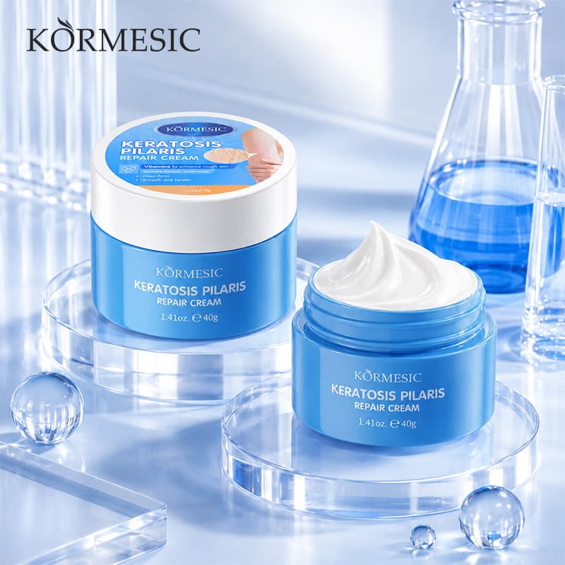 KORMESIC chicken skin repair cream cross-border full English body care chicken skin cream moisturizes skin body cream