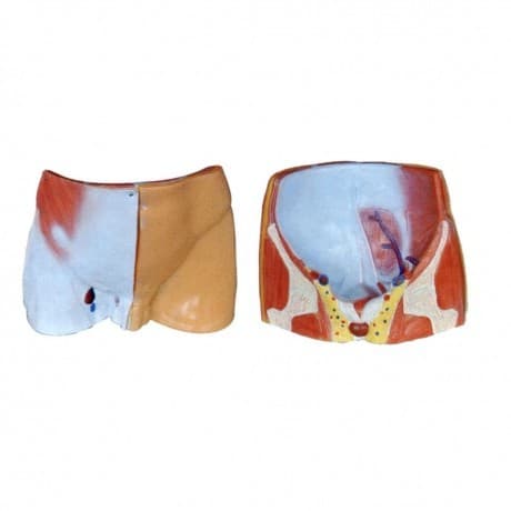 Zhongwei Medical Inguinal Region Layered Anatomy Model Human Structure Tissue Disassembly Medical Teaching Training Mold
