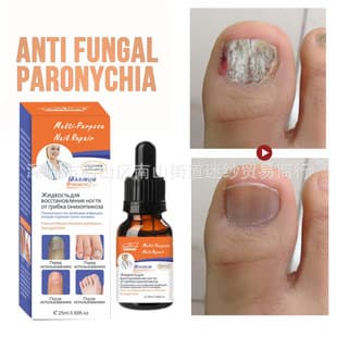 Cross-border English and Russian Nail Care Serum for Daily Hand and Foot Cleaning, Black, Yellow, Gray, Soft, and Decayed Nails
