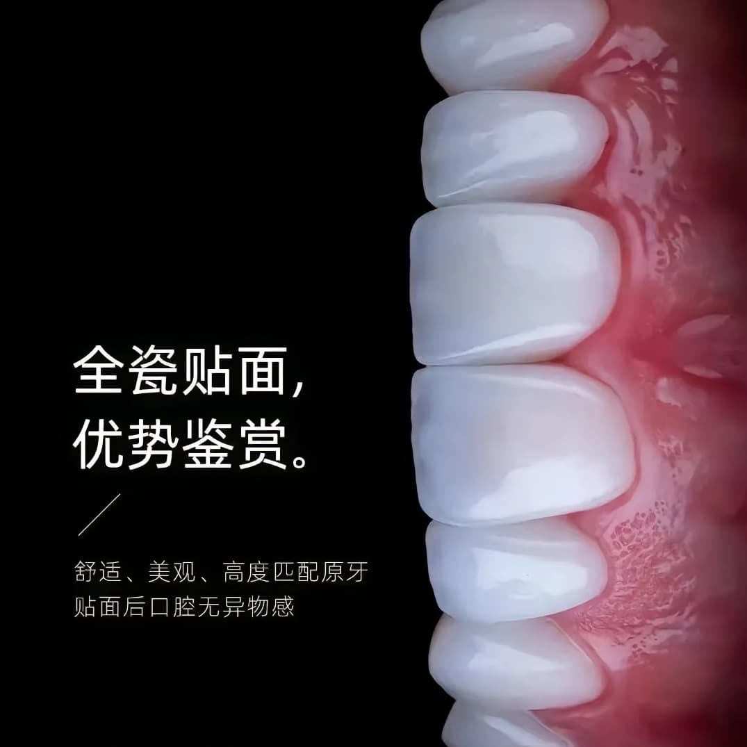 All-ceramic veneers, Ivoire Blue Porcelain, VITA Amber Porcelain, Dentsply Sirona Porcelain, Gum Protection Dentures, Whitening