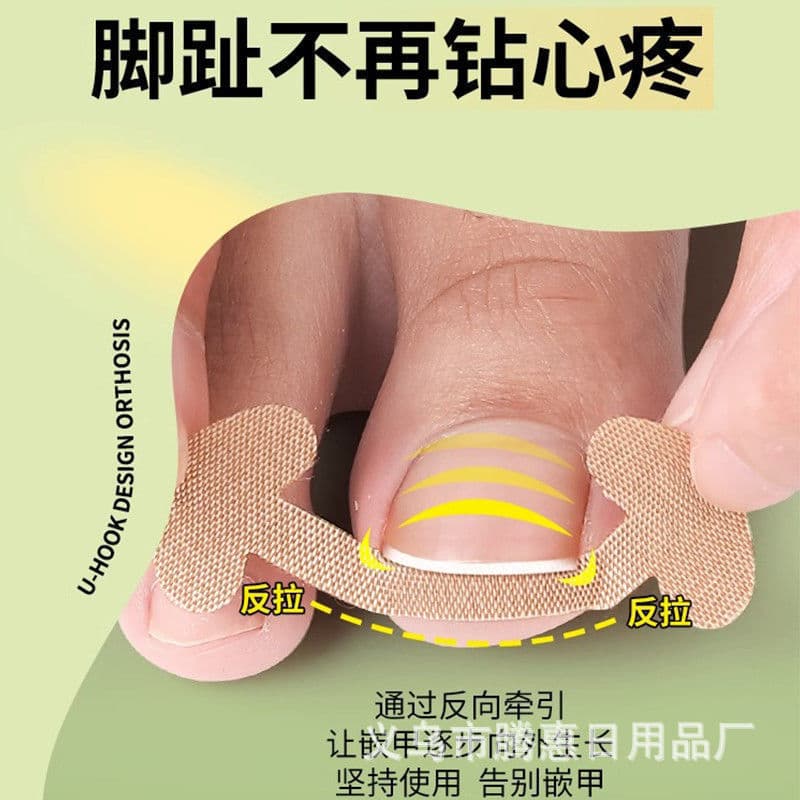 Nail Repair Pull-Up Patch, No Glue Required, Quick Toenail Deformity Correction Patch, Anti-Ingrown Toenail Adhesive Patch