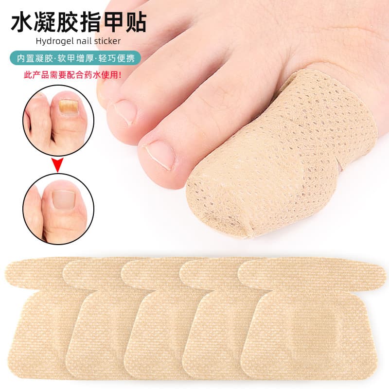 Amazon Hydrogel Onychomycosis Repair Patch Toenail Care Soft Nail Ingrown Nail Thickening Nail Groove Nail Patch