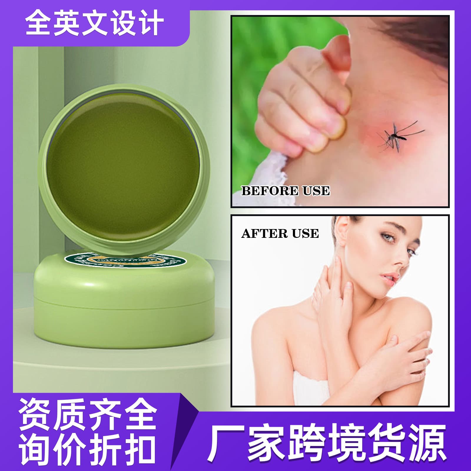 Comfrey Soothing Stick Cooling Outdoor Insect Bite Prevention Portable Itch Relief Stick Moisturizing Skin Care Comfrey Balm Insect Bite Prevention
